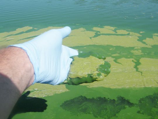 Toxic algae is fouling Nebraska lakes, raising water concerns